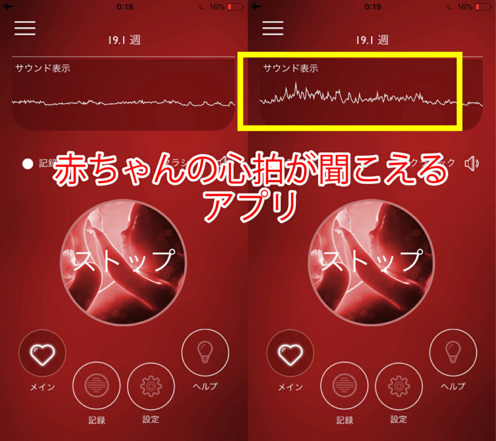 心臓の音 で健康管理 胎児から大人まで使えるヘルスケアデバイス Skeeper 動画ショッピングサイト Discover で販売開始 Discover株式会社のプレスリリース