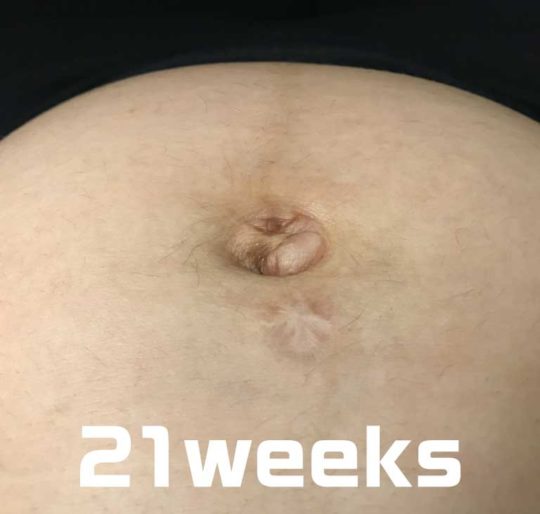 妊娠6ヶ月、21週目のおへその写真