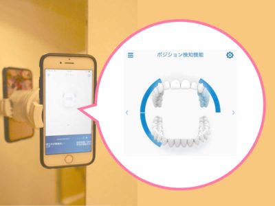 電動歯ブラシOral-B（オーラルB）のジーニアスがすごい