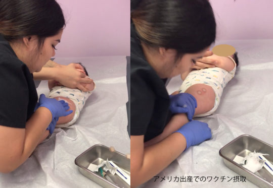 アメリカ出産の赤ちゃんのワクチン