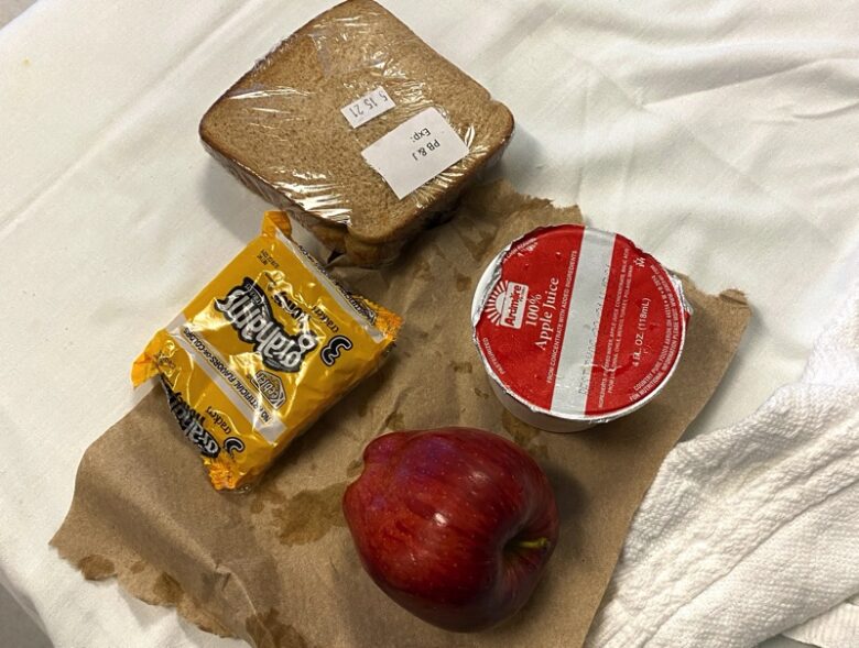 アメリカの病院食：救急車でER搬送の２歳児に「ピーナツバター＆ジャム」のサンドイッチ 